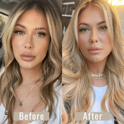 Thin-Hair-Extensions-Before-and-After